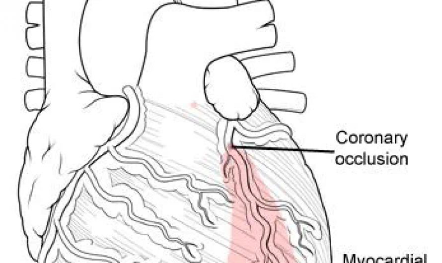 Die Zukunft der Herztransplantation